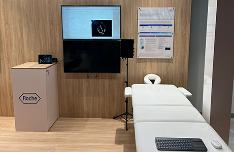 Heart Failure With Us2.ai And Roche