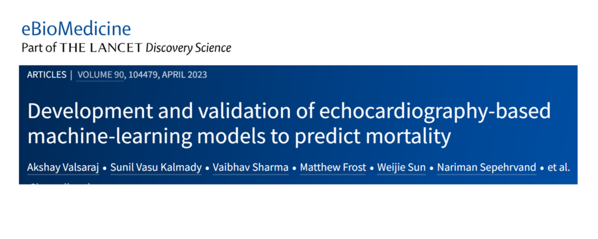 AI Echo Mortality Prediction