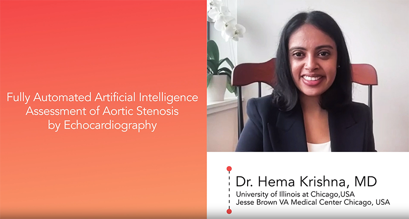 AI Echo For Aortic Stenosis Severity Assessment