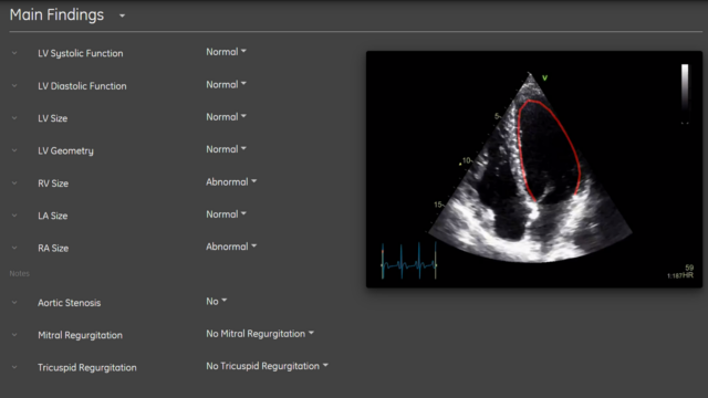 AI For Echocardiography