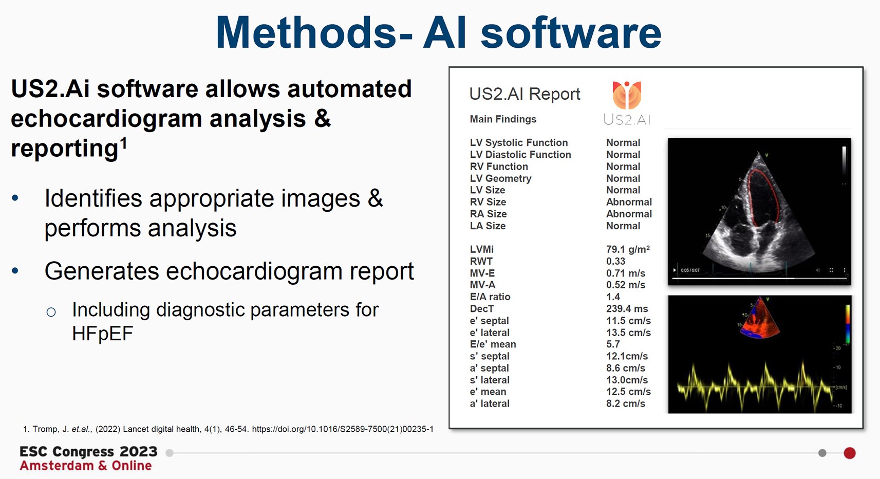 Us2.ai 100% automation of HF detection