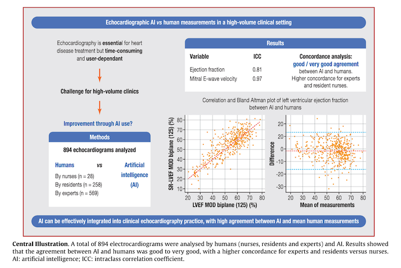 Integrating AI Into An Echocardiography Department